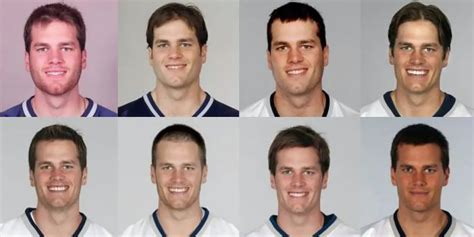 He looked way different from what he originally looked. . Tom brady plastic surgery